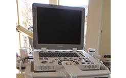 超音波診断装置